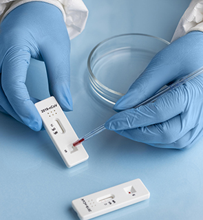Covid-19 | Testes rápidos de antigénio